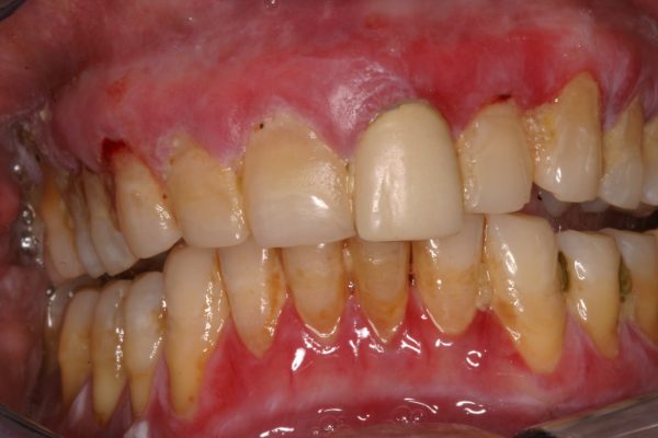 dental questions